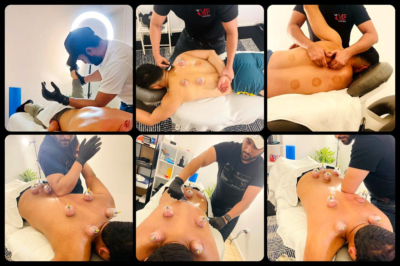 MF Sports Injury Rehab treatments — cupping therapy and sports massage in Yagoona
